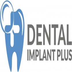 Dental Implant Plus